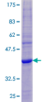 MS4A6E Protein - 12.5% SDS-PAGE of human MS4A6E stained with Coomassie Blue
