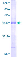 MS4A7 Protein - 12.5% SDS-PAGE of human MS4A7 stained with Coomassie Blue