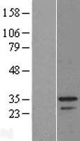 MSANTD3 Protein - Western validation with an anti-DDK antibody * L: Control HEK293 lysate R: Over-expression lysate