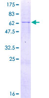 MSANTD3 Protein - 12.5% SDS-PAGE of human C9orf30 stained with Coomassie Blue