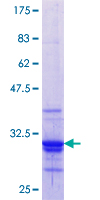 MSC / Musculin Protein - 12.5% SDS-PAGE Stained with Coomassie Blue.
