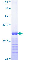 MSH2 Protein - 12.5% SDS-PAGE Stained with Coomassie Blue.