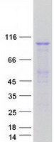 MSH2 Protein - Purified recombinant protein MSH2 was analyzed by SDS-PAGE gel and Coomassie Blue Staining