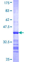 MSH4 Protein - 12.5% SDS-PAGE Stained with Coomassie Blue.