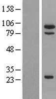 MSH5 Protein - Western validation with an anti-DDK antibody * L: Control HEK293 lysate R: Over-expression lysate