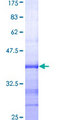 MSH5 Protein - 12.5% SDS-PAGE Stained with Coomassie Blue.