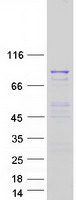 MSH5 Protein - Purified recombinant protein MSH5 was analyzed by SDS-PAGE gel and Coomassie Blue Staining