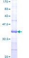 MSH6 Protein - 12.5% SDS-PAGE Stained with Coomassie Blue.