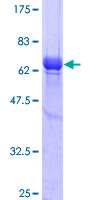 MSI2 Protein - 12.5% SDS-PAGE of human MSI2 stained with Coomassie Blue