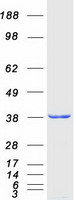 MSI2 Protein - Purified recombinant protein MSI2 was analyzed by SDS-PAGE gel and Coomassie Blue Staining