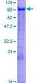 MSL2 Protein - 12.5% SDS-PAGE of human MSL2L1 stained with Coomassie Blue