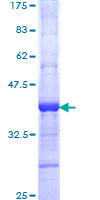 MSL2 Protein - 12.5% SDS-PAGE Stained with Coomassie Blue.