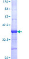 MSL2 Protein - 12.5% SDS-PAGE Stained with Coomassie Blue.