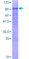MSL3L1 / MSL3 Protein - 12.5% SDS-PAGE of human MSL3L1 stained with Coomassie Blue