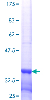 MSL3L1 / MSL3 Protein - 12.5% SDS-PAGE Stained with Coomassie Blue.
