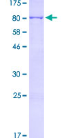 MSLN / Mesothelin Protein - 12.5% SDS-PAGE of human MSLN stained with Coomassie Blue