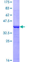 MSLN / Mesothelin Protein - 12.5% SDS-PAGE Stained with Coomassie Blue.