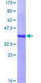 MSLN / Mesothelin Protein - 12.5% SDS-PAGE Stained with Coomassie Blue.