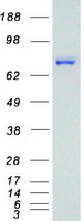 MSLN / Mesothelin Protein - Purified recombinant protein MSLN was analyzed by SDS-PAGE gel and Coomassie Blue Staining