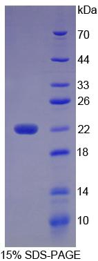 MSMB / MSP Protein - Recombinant Microseminoprotein Beta By SDS-PAGE