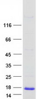 MSMP Protein - Purified recombinant protein MSMP was analyzed by SDS-PAGE gel and Coomassie Blue Staining