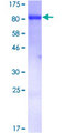 MSN / Moesin Protein - 12.5% SDS-PAGE of human MSN stained with Coomassie Blue