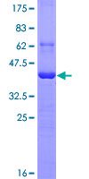 MSN / Moesin Protein - 12.5% SDS-PAGE Stained with Coomassie Blue.