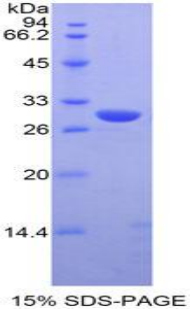 MSN / Moesin Protein - Recombinant Moesin By SDS-PAGE