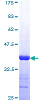 MSR1 / CD204 Protein - 12.5% SDS-PAGE Stained with Coomassie Blue.
