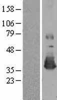 MSRA Protein - Western validation with an anti-DDK antibody * L: Control HEK293 lysate R: Over-expression lysate