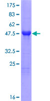 MSRA Protein - 12.5% SDS-PAGE of human MSRA stained with Coomassie Blue