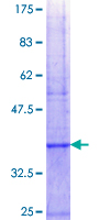 MSRA Protein - 12.5% SDS-PAGE Stained with Coomassie Blue.