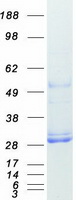 MSRA Protein - Purified recombinant protein MSRA was analyzed by SDS-PAGE gel and Coomassie Blue Staining