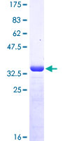 MSRB2 / MSRB Protein - 12.5% SDS-PAGE Stained with Coomassie Blue.