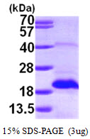 MSRB2 / MSRB Protein