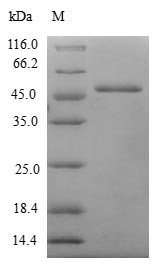 MSRB3 Protein - (Tris-Glycine gel) Discontinuous SDS-PAGE (reduced) with 5% enrichment gel and 15% separation gel.