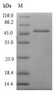 MSRB3 Protein - (Tris-Glycine gel) Discontinuous SDS-PAGE (reduced) with 5% enrichment gel and 15% separation gel.