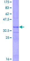 MST1 Protein - 12.5% SDS-PAGE Stained with Coomassie Blue.