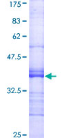 MST1R / RON Protein - 12.5% SDS-PAGE Stained with Coomassie Blue.