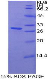 MST1R / RON Protein - Recombinant Macrophage Stimulating 1 Receptor By SDS-PAGE