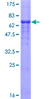 MSTN / GDF8 / Myostatin Protein - 12.5% SDS-PAGE of human GDF8 stained with Coomassie Blue