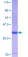 MSTN / GDF8 / Myostatin Protein - 12.5% SDS-PAGE Stained with Coomassie Blue.
