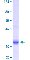 MSTN / GDF8 / Myostatin Protein - 12.5% SDS-PAGE Stained with Coomassie Blue.