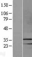 MSX1 Protein - Western validation with an anti-DDK antibody * L: Control HEK293 lysate R: Over-expression lysate