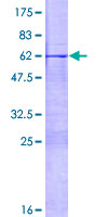 MSX1 Protein - 12.5% SDS-PAGE of human MSX1 stained with Coomassie Blue