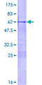 MSX1 Protein - 12.5% SDS-PAGE of human MSX1 stained with Coomassie Blue
