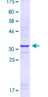 MSX1 Protein - 12.5% SDS-PAGE Stained with Coomassie Blue.