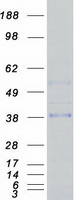 MSX1 Protein - Purified recombinant protein MSX1 was analyzed by SDS-PAGE gel and Coomassie Blue Staining