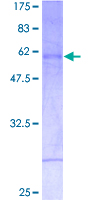 MSX2 / MSH Protein - 12.5% SDS-PAGE of human MSX2 stained with Coomassie Blue