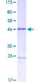 MSX2 / MSH Protein - 12.5% SDS-PAGE Stained with Coomassie Blue.
